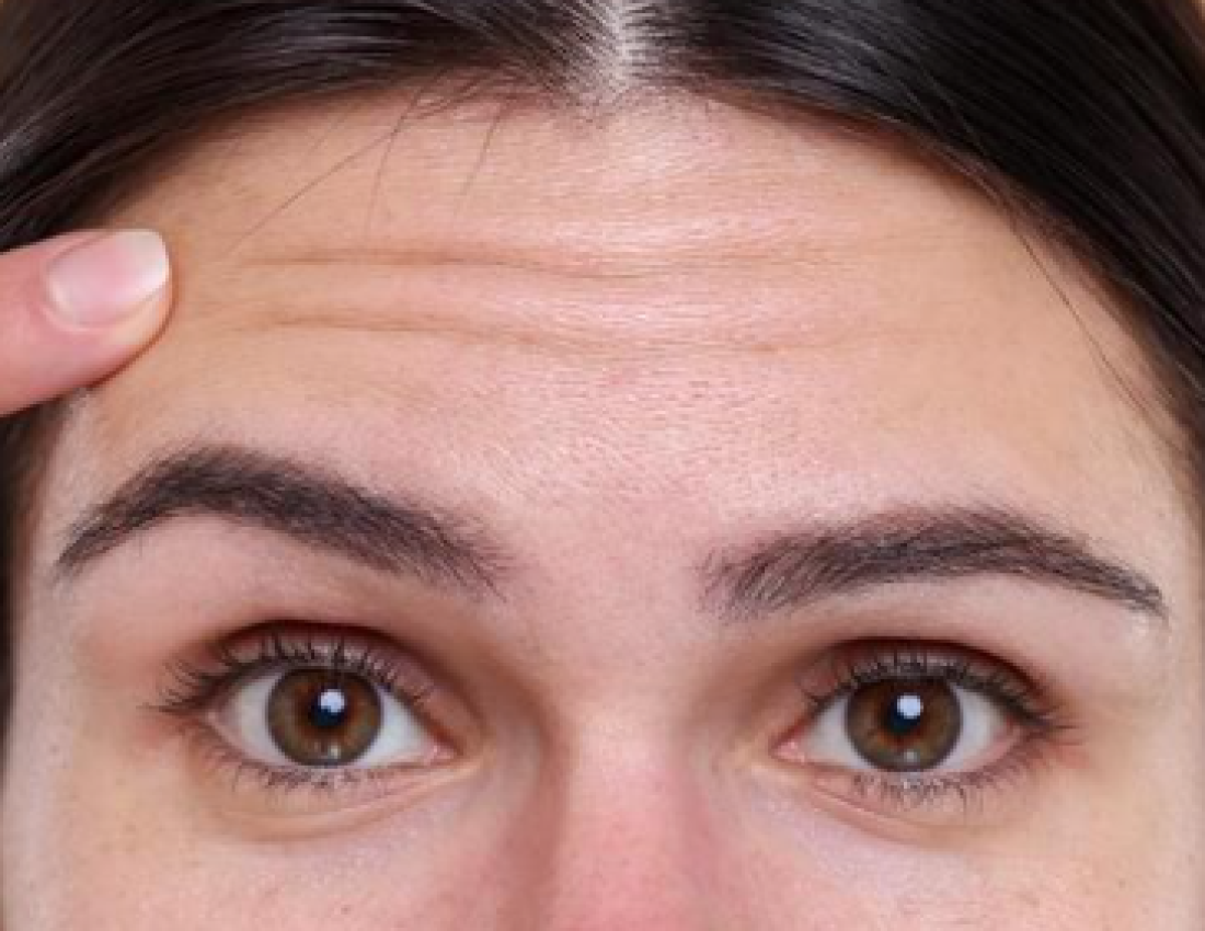 rides-ou-ridules-:-comment-les-reconnaitre-et-les-atteacute;nuer-efficacement